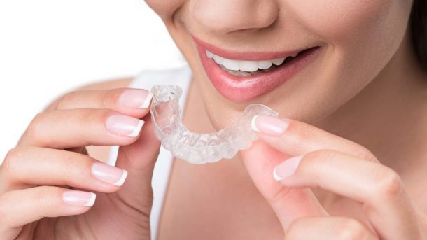 Things You Wish You Knew Before Getting Invisible Braces